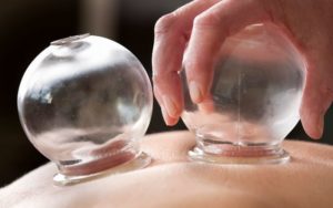 Myofascial Decompression_Cupping